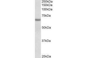 Western Blotting (WB) image for anti-Cytochrome B5 Reductase 4 (CYB5R4) (Internal Region) antibody (ABIN2465085) (CYB5R4 anticorps  (Internal Region))