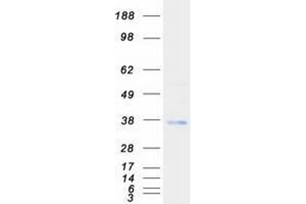 TMX2 Protein (Transcript Variant 1) (Myc-DYKDDDDK Tag)