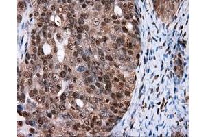 Immunohistochemical staining of paraffin-embedded colon tissue using anti-FAHD2A mouse monoclonal antibody. (FAHD2A anticorps)