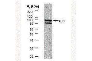 Western Blotting (WB) image for anti-Programmed Cell Death 6 Interacting Protein (PDCD6IP) antibody (ABIN2477348) (ALIX anticorps)