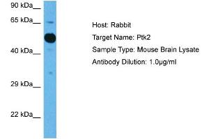 Host: Mouse Target Name: PTK2 Sample Tissue: Mouse Brain Antibody Dilution: 1ug/ml (FAK anticorps  (Middle Region))