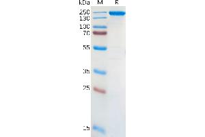 Human ALK Protein, hFc Tag on SDS-PAGE under reducing condition (ALK Protein (AA 31-692) (Fc Tag))