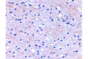 Immunohistochemistry of BRAL1 Antibody Immunohistochemistry of BRAL1 antibody. (HAPLN2 anticorps  (Internal Region))