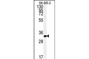Western blot analysis of FA1 Antibody (Center) (ABIN651364 and ABIN2840202) in SK-BR-3 cell line lysates (35 μg/lane). (FAM92A1 anticorps  (AA 113-141))