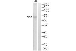 Western Blotting (WB) image for anti-CD6 (CD6) (Internal Region) antibody (ABIN1852261) (CD6 anticorps  (Internal Region))