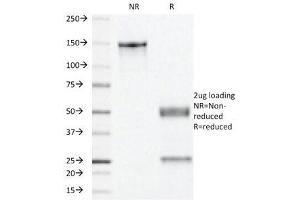 SDS-PAGE Analysis of Purified, BSA-Free Progesterone Receptor Antibody (clone PR501). (Progesterone Receptor anticorps)