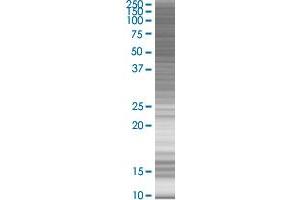 MEF2C transfected lysate. (MEF2C 293T Cell Transient Overexpression Lysate(Denatured))