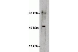 Western blot on human kidney lysate (10 ug/lane) using  anti Serine palmitoyltransferase 1 antibody (cat X2066P) at 1 ug/ml. (SPTLC1 anticorps)