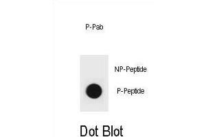 Dot blot analysis of PTEN Antibody (Phospho ) Phospho-specific Pab (ABIN6241056 and ABIN6578943) on nitrocellulose membrane. (PTEN anticorps  (pTyr315))