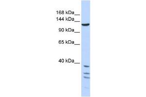 TNKS antibody used at 1 ug/ml to detect target protein. (TNKS anticorps  (Middle Region))