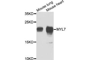 Western blot analysis of extracts of mouse lung and mouse heart cells, using MYL7 antibody. (MYL7 anticorps)