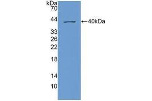 Detection of Recombinant NAP3, Human using Polyclonal Antibody to Chemokine (C-X-C Motif) Ligand 1 (CXCL1) (CXCL1 anticorps  (AA 35-107))