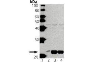 Western blot analysis of anti-Ras pAb: Lane 1: MW marker, Lane 2: HeLa lysate, Mouse Brain Lysate, Rat Brain Lysate. (RAS anticorps)