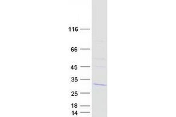 LSM12B Protein (Myc-DYKDDDDK Tag)