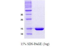 SDS-PAGE (SDS) image for alpha Synuclein DeltaNAC (AA 61-95) protein (ABIN666814) (alpha Synuclein DeltaNAC (AA 61-95) Protéine)