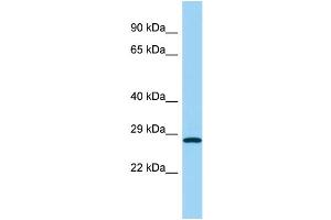 Host: Rabbit Target Name: UCHL1 Sample Type: Fetal Kidney lysates Antibody Dilution: 1. (UCHL1 anticorps  (Middle Region))