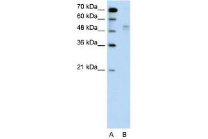 WWP2 antibody used at 1 ug/ml to detect target protein. (WWP2 anticorps  (Middle Region))