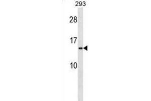 Western Blotting (WB) image for anti-Ribosomal Protein S20 (RPS20) antibody (ABIN2998579) (RPS20 anticorps)