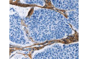Immunohistochemistry (IHC) image for anti-Collagen, Type III, alpha 1 (COL3A1) antibody (ABIN2421423) (COL3A1 anticorps)