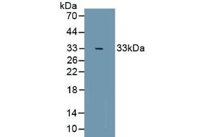 Detection of Recombinant ZFHX1B, Mouse using Polyclonal Antibody to Zinc Finger Homeobox Protein 1B (ZFHX1B) (ZEB2 anticorps  (AA 962-1215))
