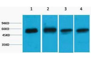 Western Blotting (WB) image for anti-V-Akt Murine Thymoma Viral Oncogene Homolog 3 (Protein Kinase B, Gamma) (AKT3) antibody (ABIN3181292) (AKT3 anticorps)