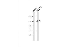 Western Blot at 1:16000 dilution Lane 1: Jurkat whole cell lysate Lane 2: MOLT-4 whole cell lysate Lysates/proteins at 20 ug per lane. (BCL11B anticorps  (AA 307-334))