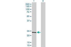 Western Blot analysis of TIMP2 expression in transfected 293T cell line by TIMP2 MaxPab polyclonal antibody. (TIMP2 anticorps  (AA 1-220))