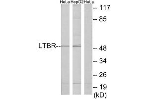 Western blot analysis of extracts from HeLa cells and HepG2 cells, using LTBR antibody. (LTBR anticorps  (N-Term))