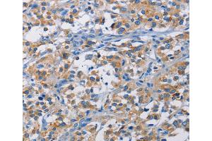 Immunohistochemistry (IHC) image for anti-RPTOR Independent Companion of mTOR, Complex 2 (RICTOR) antibody (ABIN2422798) (RICTOR anticorps)