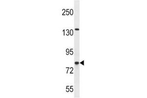 CPT1B antibody western blot analysis in SK-BR-3 lysate (CPT1B anticorps  (AA 744-770))