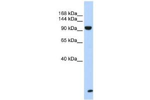 TNRC6B antibody used at 1 ug/ml to detect target protein. (TNRC6B anticorps  (N-Term))