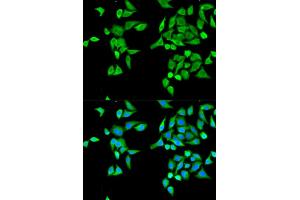 Immunofluorescence analysis of MCF-7 cells using CES2 antibody (ABIN5970708). (CES2 anticorps)