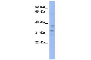 WB Suggested Anti-KBTBD5 Antibody Titration:  0. (KBTBD5 anticorps  (Middle Region))