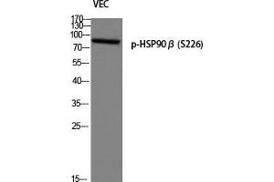 Western Blot (WB) analysis of VEC using p-HSP90beta (S226) antibody. (HSP90AB1 anticorps  (pSer226))