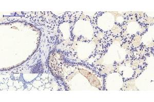 Immunohistochemistry of paraffin-embedded Rat lung tissue with Phospho-Stat1 (Tyr701) Polyclonal Antibody at dilution of 1:200 (STAT1 anticorps  (pTyr701))
