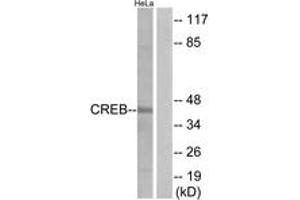 Western blot analysis of extracts from HeLa cells, treated with UV 15', using CREB (Ab-129) Antibody. (CREB1 anticorps  (AA 96-145))
