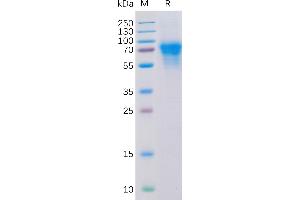 Human CD46 Protein, His Tag on SDS-PAGE under reducing condition. (CD46 Protein (CD46) (AA 35-328) (His tag))