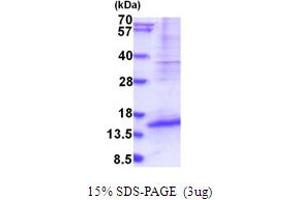 SDS-PAGE (SDS) image for Developmental Pluripotency Associated 5 (DPPA5) (AA 1-116) protein (His tag) (ABIN5853995) (DPPA5 Protein (AA 1-116) (His tag))