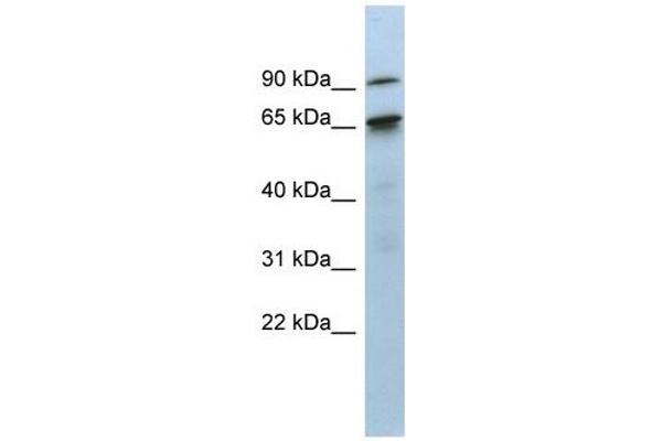 CTIF/KIAA0427 anticorps  (N-Term)