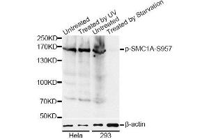 Western blot analysis of extracts of HeLa and 293 cells, using Phospho-SMC1A-S957 antibody (ABIN5969934) at 1/1000 dilution. (SMC1A anticorps  (pSer957))