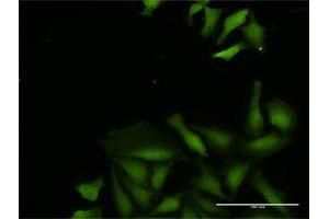 Immunofluorescence of purified MaxPab antibody to CDADC1 on HeLa cell. (CDADC1 anticorps  (AA 1-514))