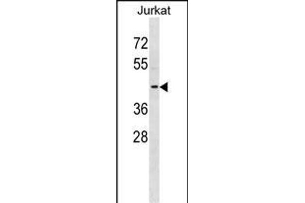 KCNAB3 anticorps  (AA 176-204)