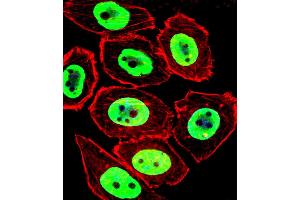 Fluorescent confocal image of U251 cell stained with EWSR1 Antibody . (EWSR1 anticorps  (C-Term))