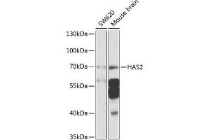 Western blot analysis of extracts of various cell lines, using H antibody (ABIN6129690, ABIN6141613, ABIN6141614 and ABIN6225245) at 1:1000 dilution. (HAS2 anticorps  (AA 67-185))