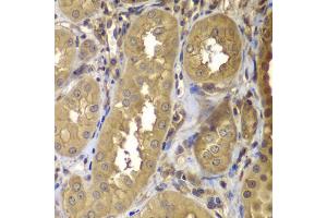 Immunohistochemistry of paraffin-embedded human kidney using PTK2 antibody (ABIN5971141) at dilution of 1/100 (40x lens). (FAK anticorps)