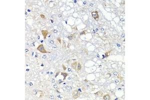 Immunohistochemistry of paraffin-embedded rat brain using PSPH antibody. (PSPH anticorps  (AA 1-225))