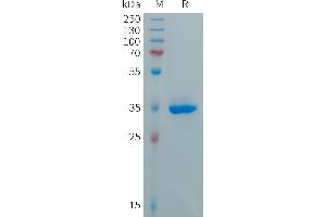 Human C Protein, hFc Tag on SDS-PAGE under reducing condition. (CXCL5 Protein (Fc Tag))