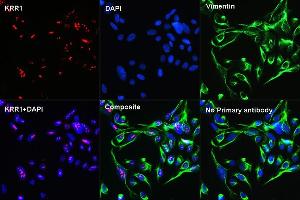 Confocal Immunofluorescent analysis of U2OS cells using KRR1 Rabbit pAb  at dilution of 1:100 (40x lens)(red). (KRR1 anticorps  (AA 1-381))