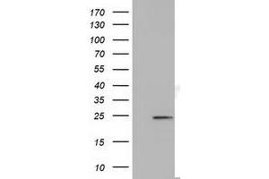 HEK293T cells were transfected with the pCMV6-ENTRY control (Left lane) or pCMV6-ENTRY MOBKL2B (Right lane) cDNA for 48 hrs and lysed. (MOBKL2B anticorps)