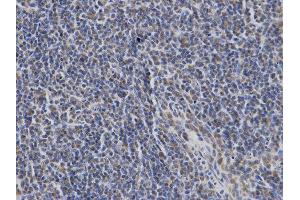 Immunohistochemistry (IHC) image for anti-Lymphocyte Cytosolic Protein 2 (SH2 Domain Containing Leukocyte Protein of 76kDa) (LCP2) antibody (ABIN1873525) (LCP2 anticorps)